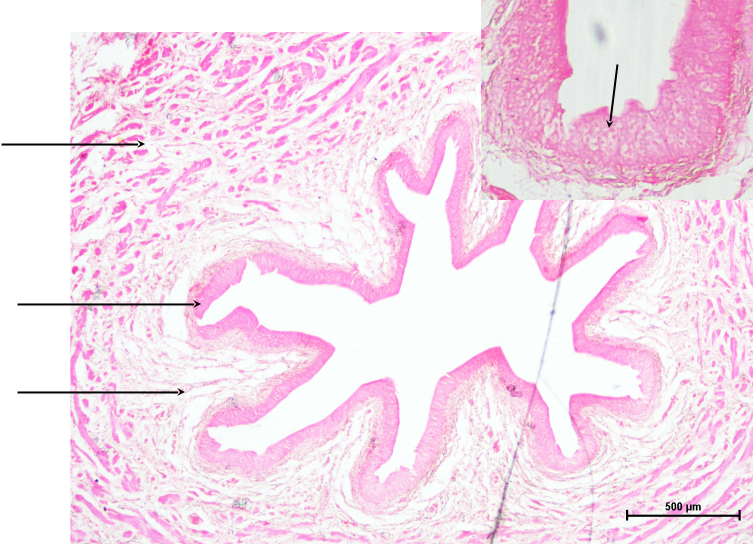 Ureter 1
